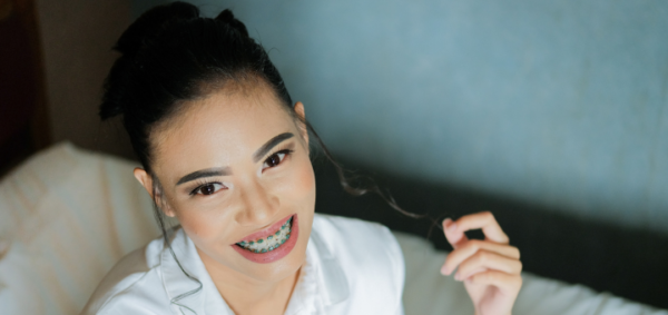 The Best Age To Get Braces: Is Age A Factor?